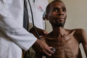 Check Your HIV Status Once You Begin To Notice These New Signs In Your Body 15 HIV