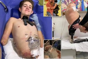 US Man Who Was Cut In Half By Forklift
