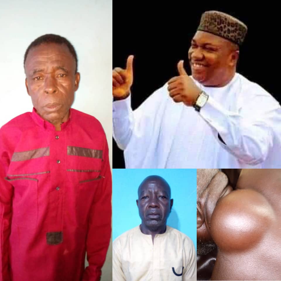 Former Governor Ugwuanyi's Free Surgery Programme Saves Lives Of Three Individuals In Enugu State 1 IMG 20240608 WA0003