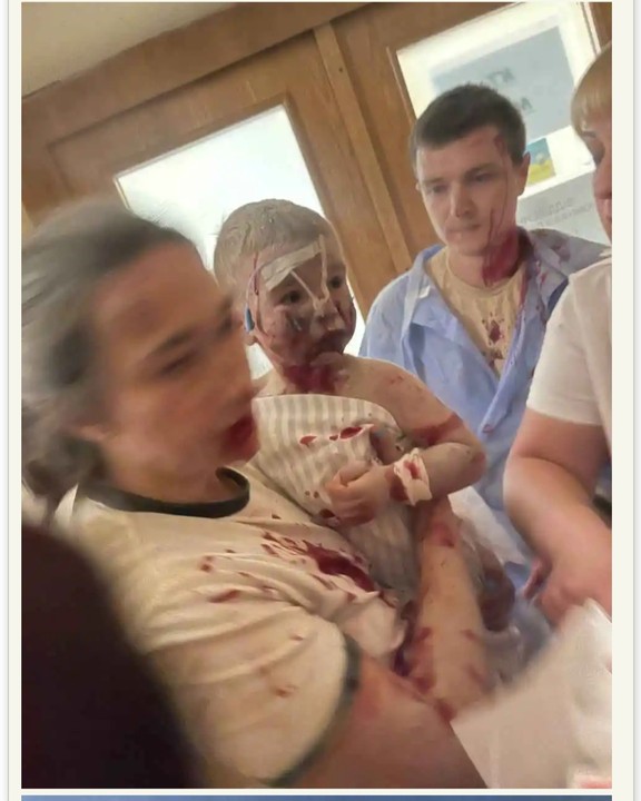 Children's Hospital Hit As Russian Strikes Kill Dozens In Ukraine 1 Russian Strikes Kill Dozens In Ukraine