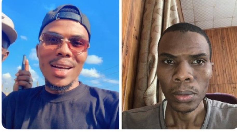 #EndBadGovernance Protester Shares Photos Of Before Arrest Vs After Release By DSS 1 Protester Shares Photos Before His Arrest