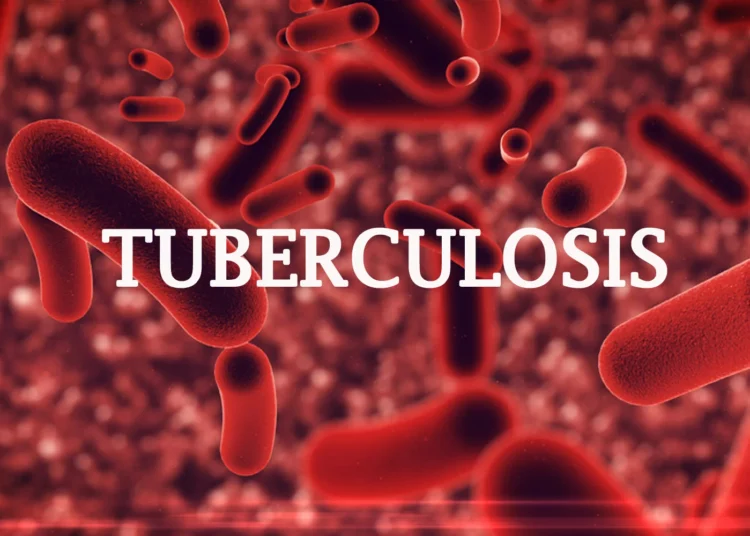 Nigeria TB Crisis:$404m Needed To Sustain Life Saving Services In 2025 1 IMG 5891