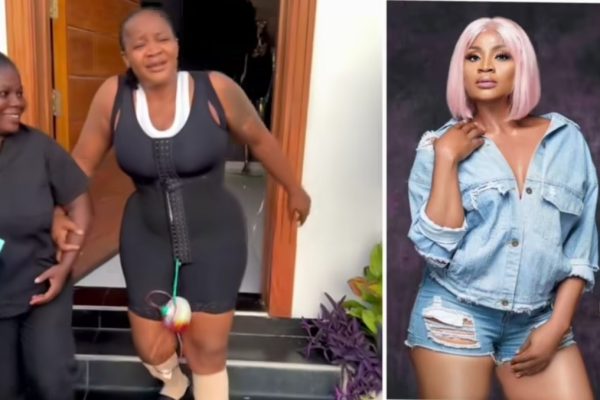 Actress, Uche Ogbodo Recovers from BBL and Tummy Tuck, Says “Film Am Well Well” 13 1000092460