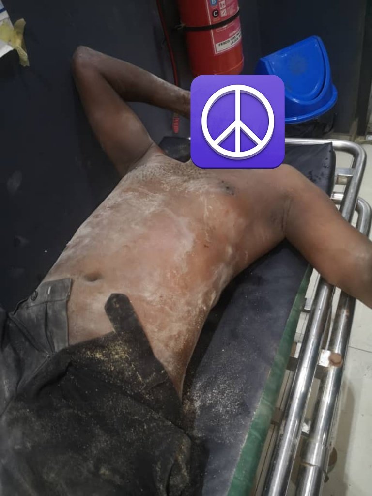 Victims Rescued and Hospitalized After Lagos Building Collapse 1 IMG 8813